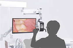 マイクロスコープ