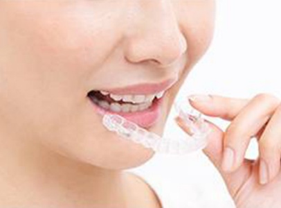 マウスピース型カスタムメイド矯正装置（SureSmile）