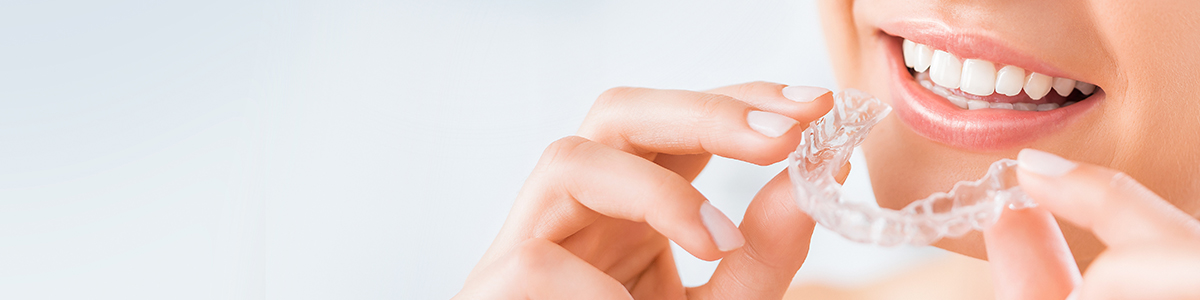 マウスピース矯正(SureSmile)